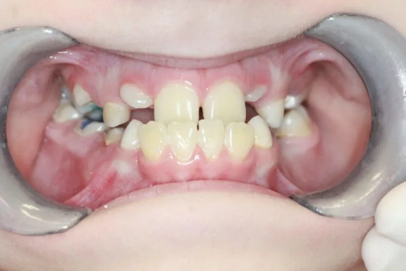 Kiedy z dzieckiem do ortodonty