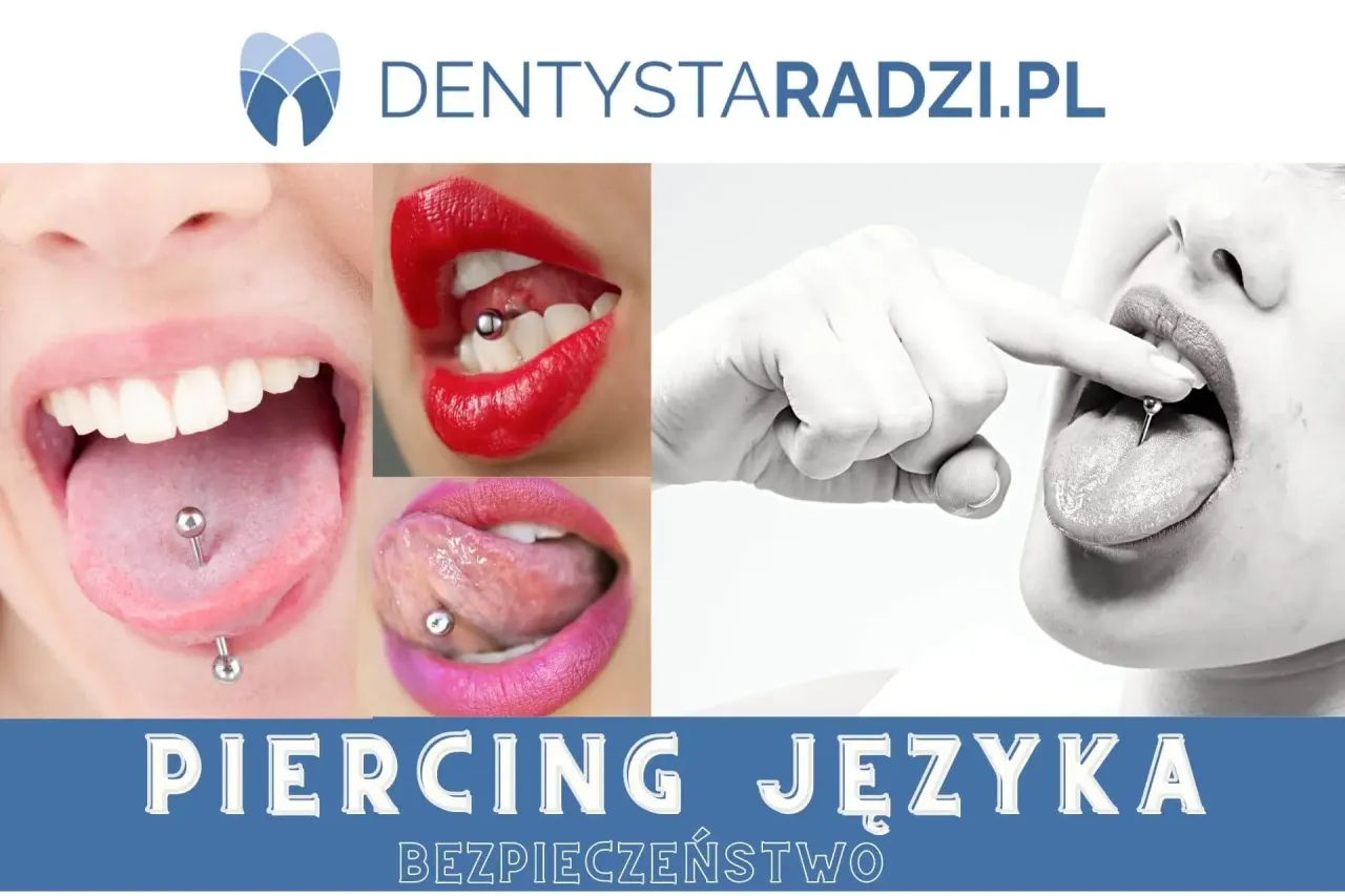 Zdjęcia uszkodzeń zębów i dziąseł od kolczyka w języku