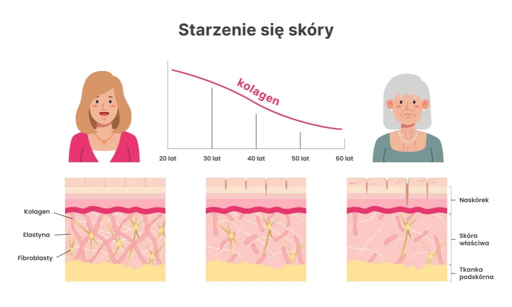 objawy niedoboru kolagenu na sk&oacute;rze przed i po