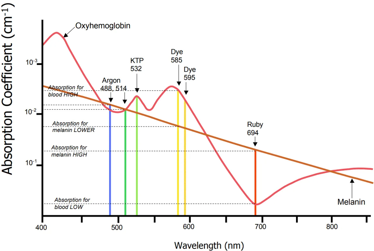 por&oacute;wnanie laser frakcyjny ablacyjny nieablacyjny infografika