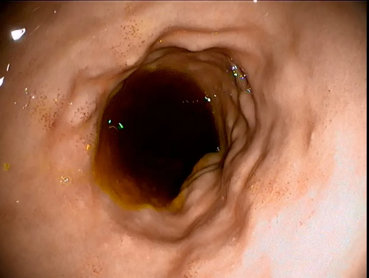 Weterynarz wykonujący gastroskopię konia