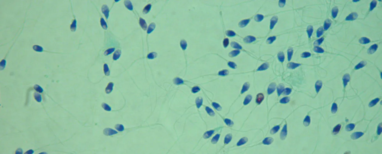 plemniki w preejakulacie, preejakulat pod mikroskopem, ryzyko ciąży