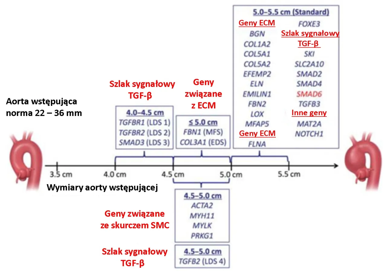 Zesp&oacute;ł Marfana co to jest