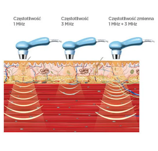 fale ultradźwiękowe schemat fizykoterapia