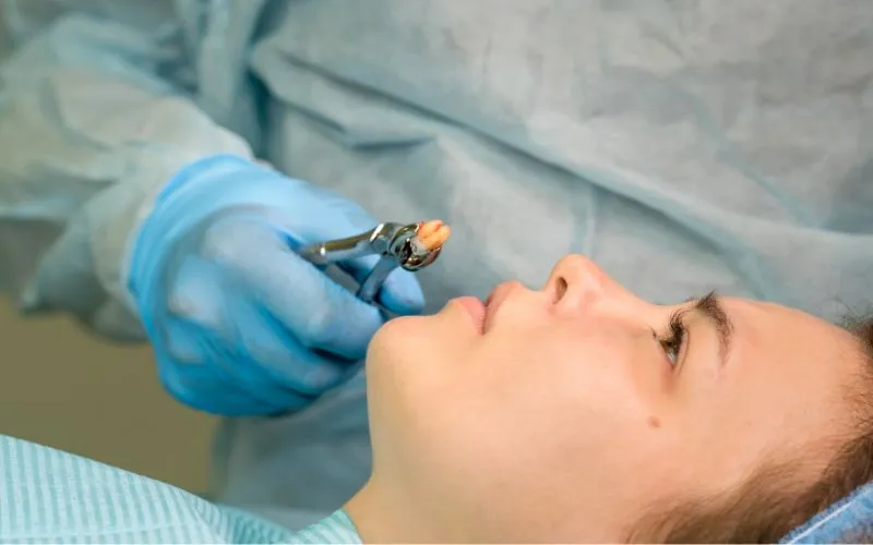 Pacjent po wyrwaniu zęba odpoczywający w domu