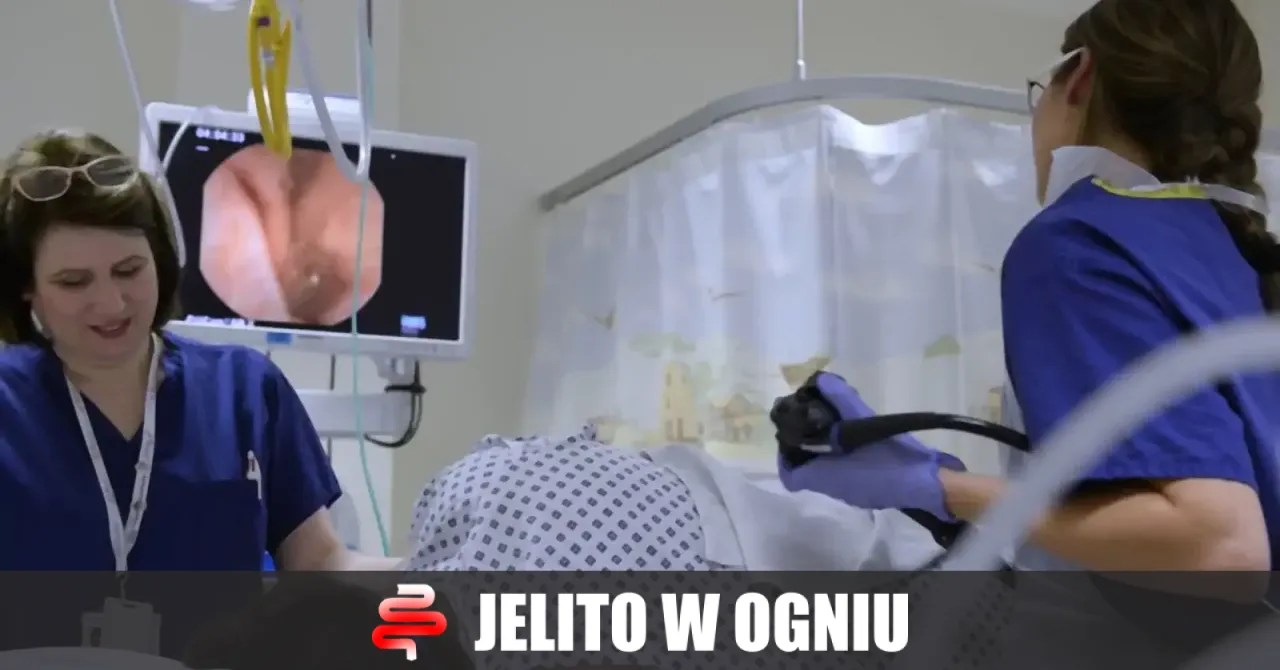 Przygotowanie do kolonoskopii w placówce