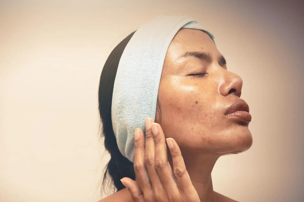 Frau mit fettiger Haut und Glanz auf der Stirn