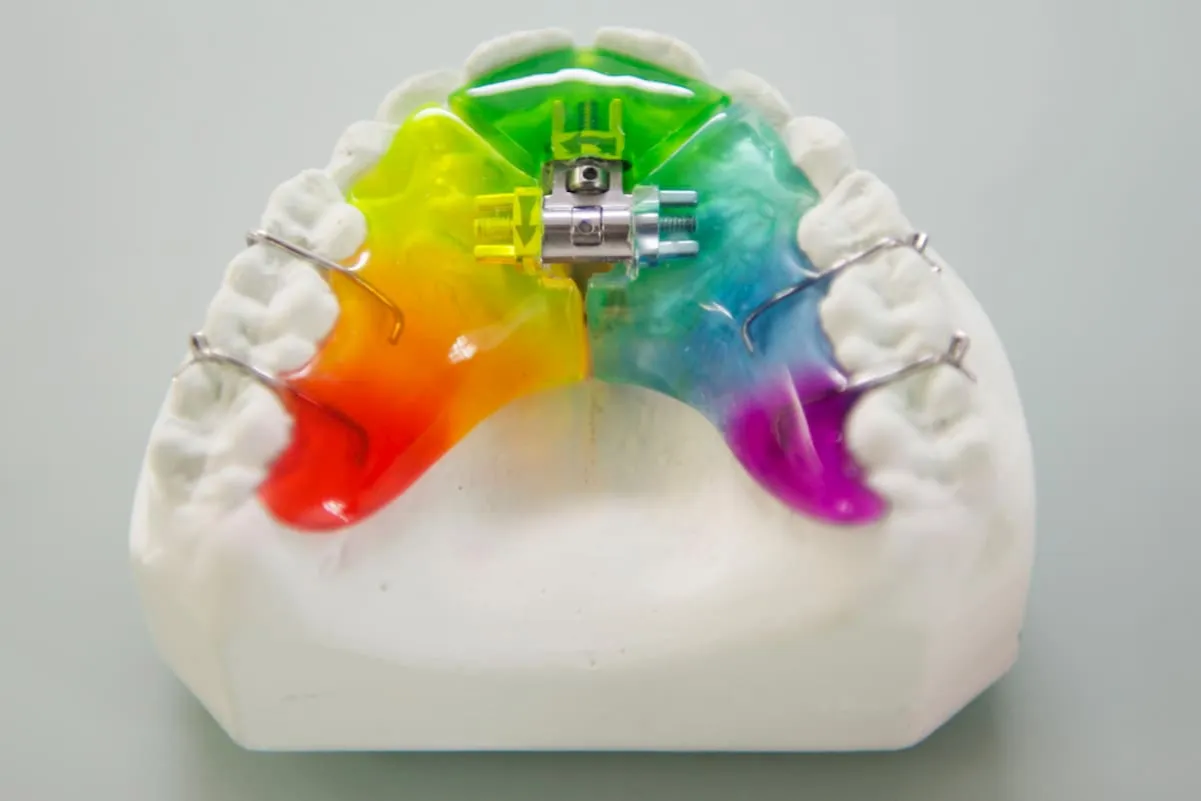 kolorowe aparaty ruchome dla dzieci wzory