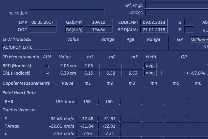 Kalkulator ciąży reguła Naegelego USG