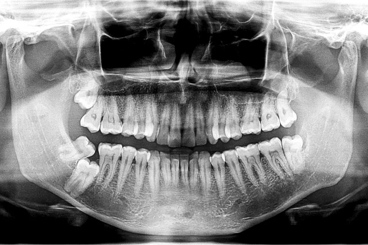 Dentysta diagnozujący ruszający się ząb RTG