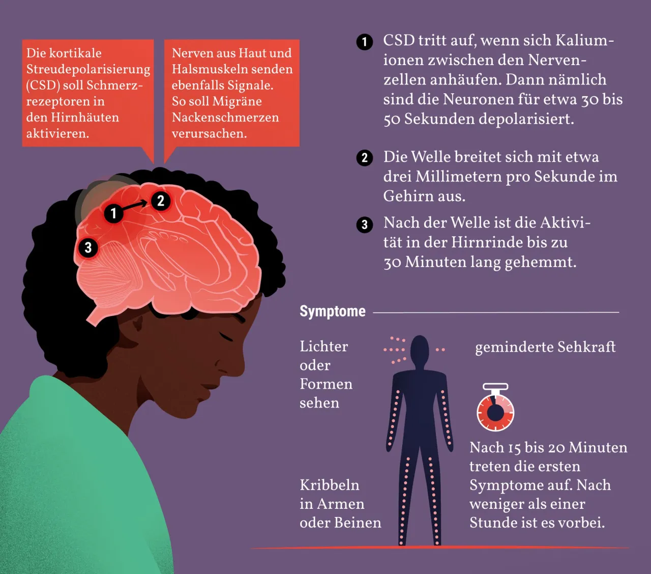 Zdjęcie Migräne Symptome: Erkennen Sie die Anzeichen und vermeiden Sie Schmerzen