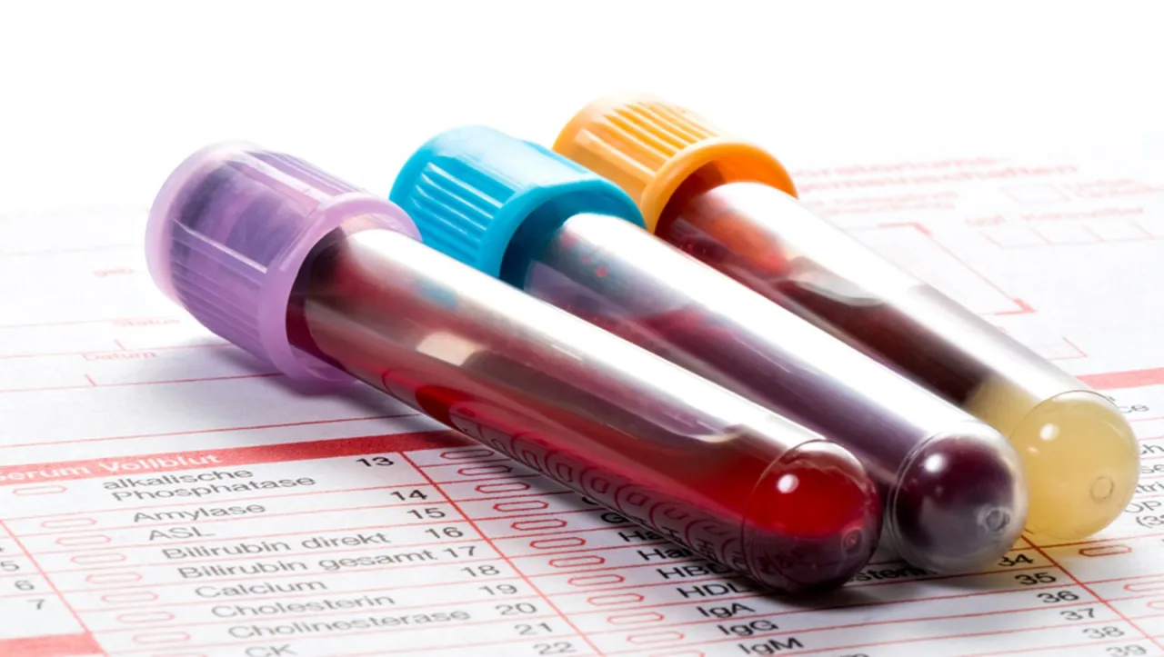 leki a badanie krwi morfologia