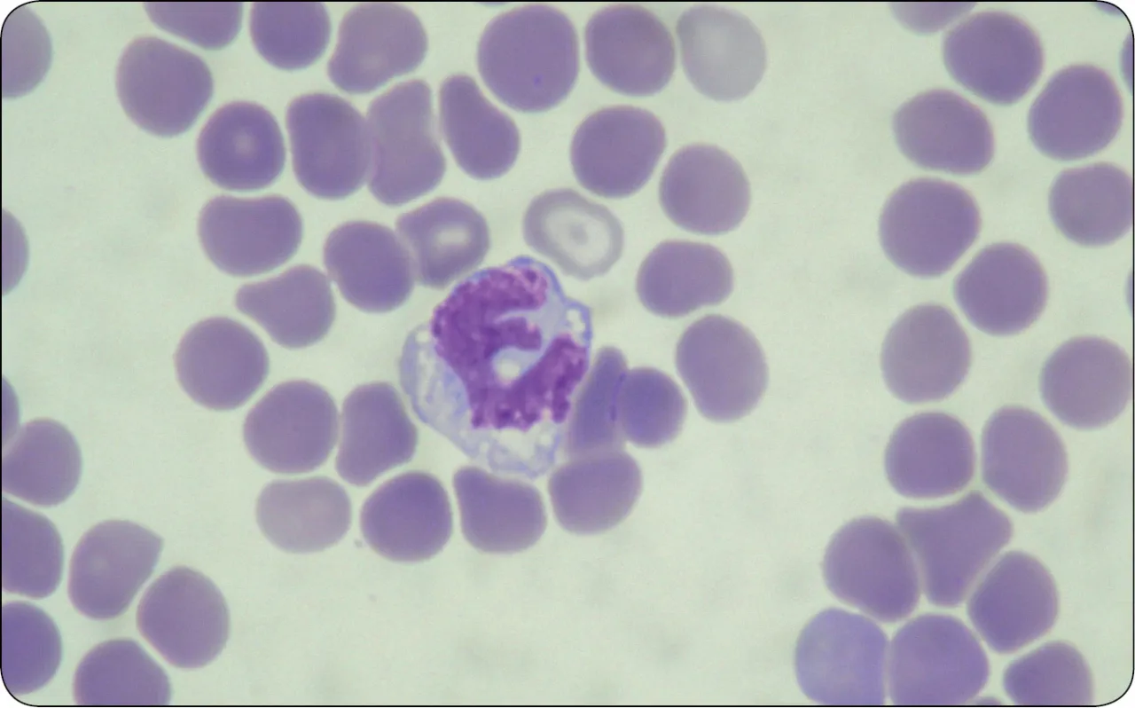 rozmaz krwi obwodowej pod mikroskopem