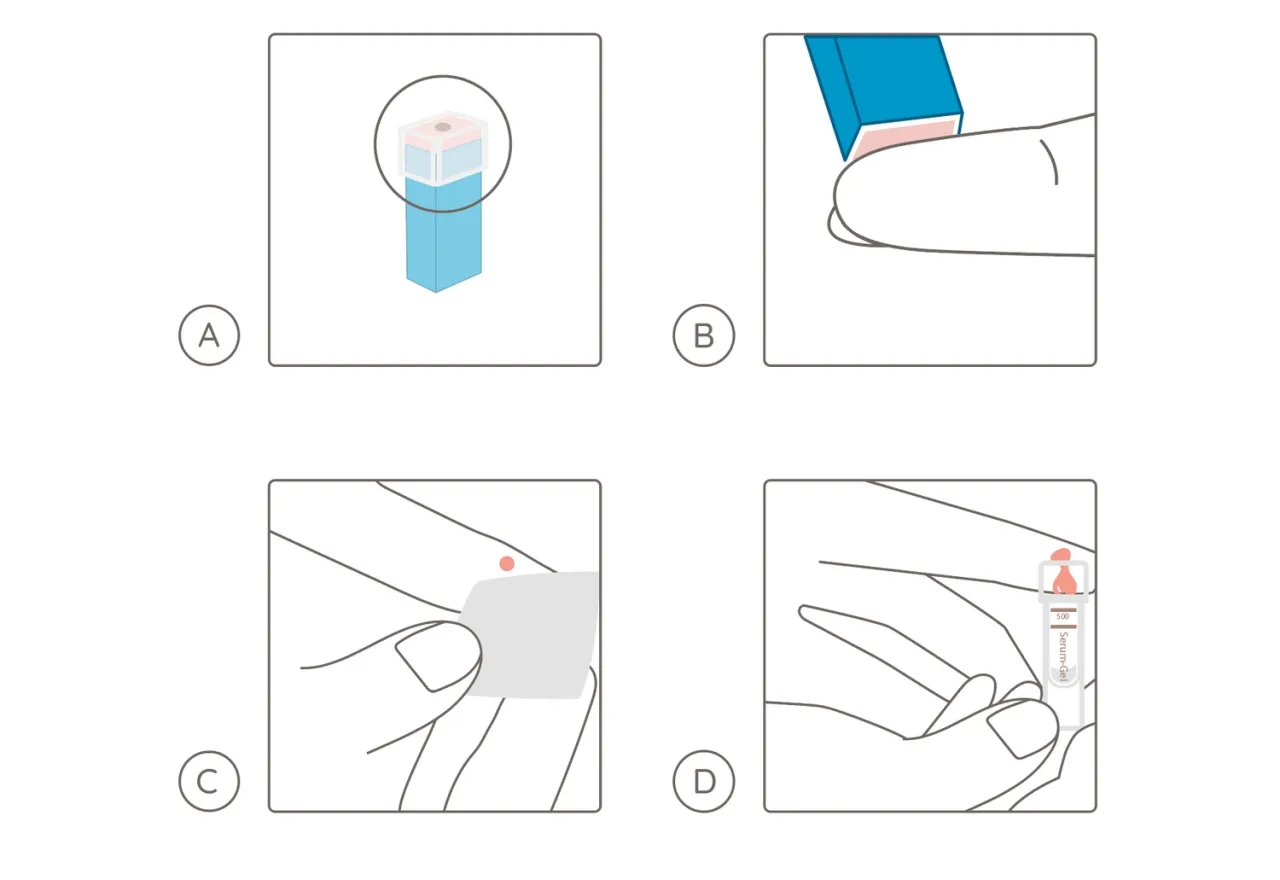 Bluttest R&ouml;hrchen Vitamin D Labor