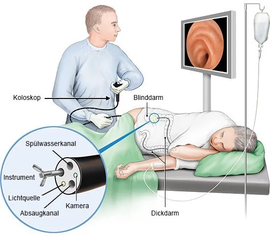 Koloskopie Ablauf Patient
