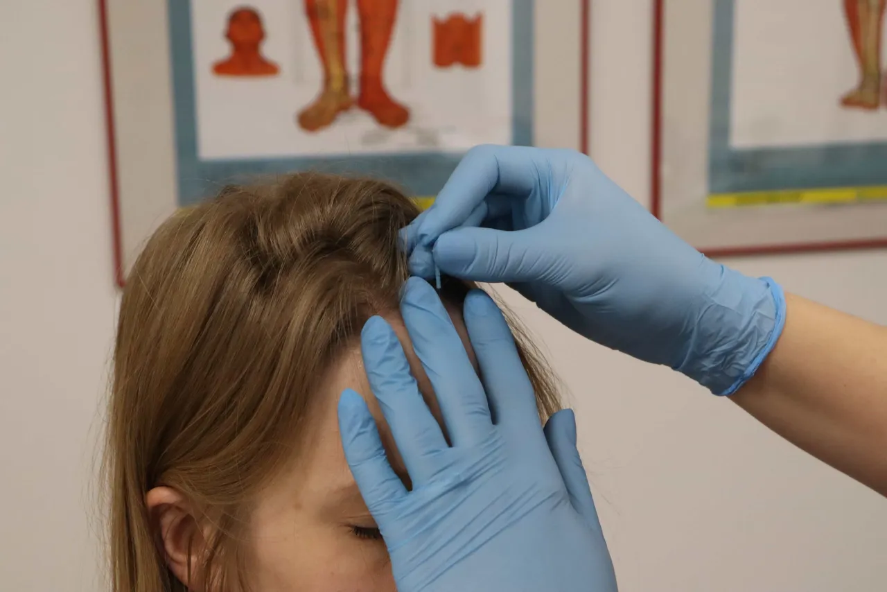 akupunktura cennik Tychy