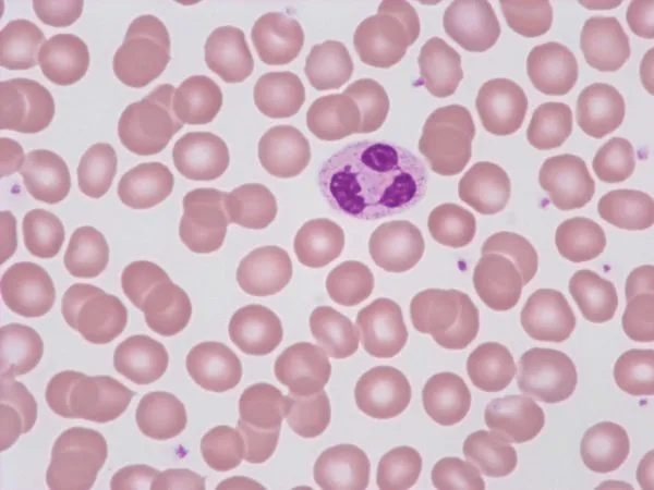 mikroskopowy obraz komórek krwi