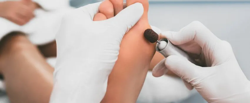 Fu&szlig;pflege bei Polyneuropathie Tipps