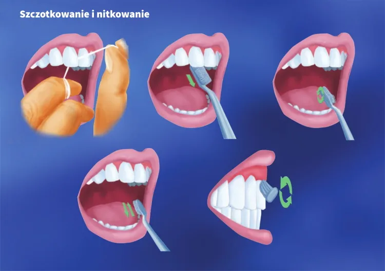 Prawidłowe szczotkowanie zębów i nitkowanie