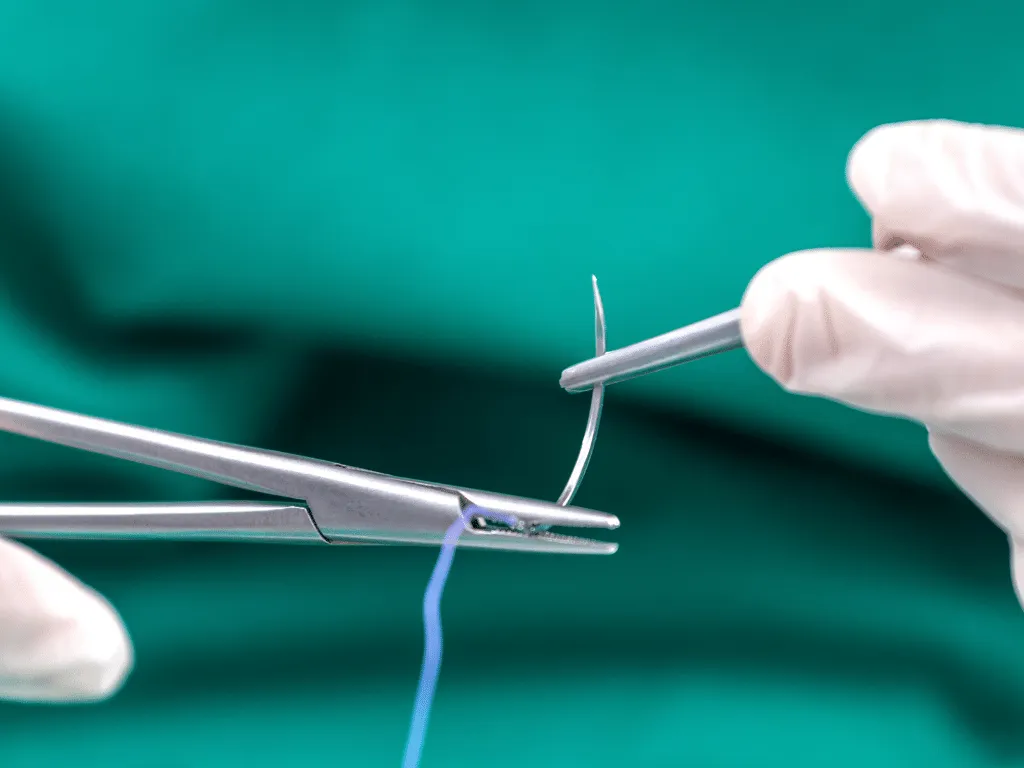 szwy po ekstrakcji zęba rodzaje i wygląd