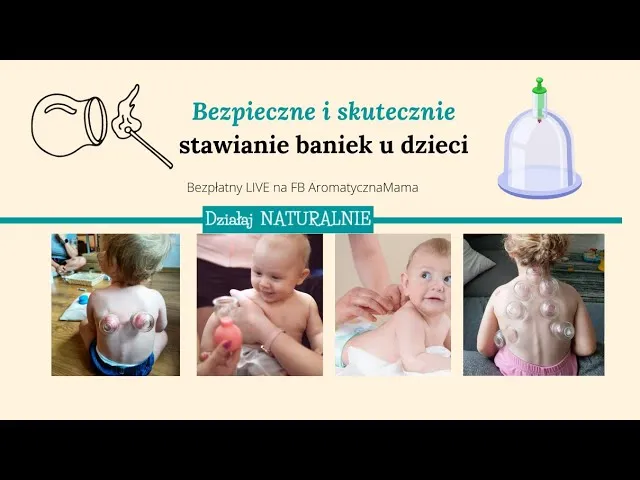 Zdjęcie Gdzie stawiać bańki dziecku, aby uniknąć błędów i zagrożeń?