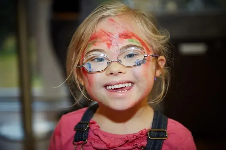 Zdjęcie Dlaczego osoby z zespołem Downa wyglądają tak samo? Oto powody