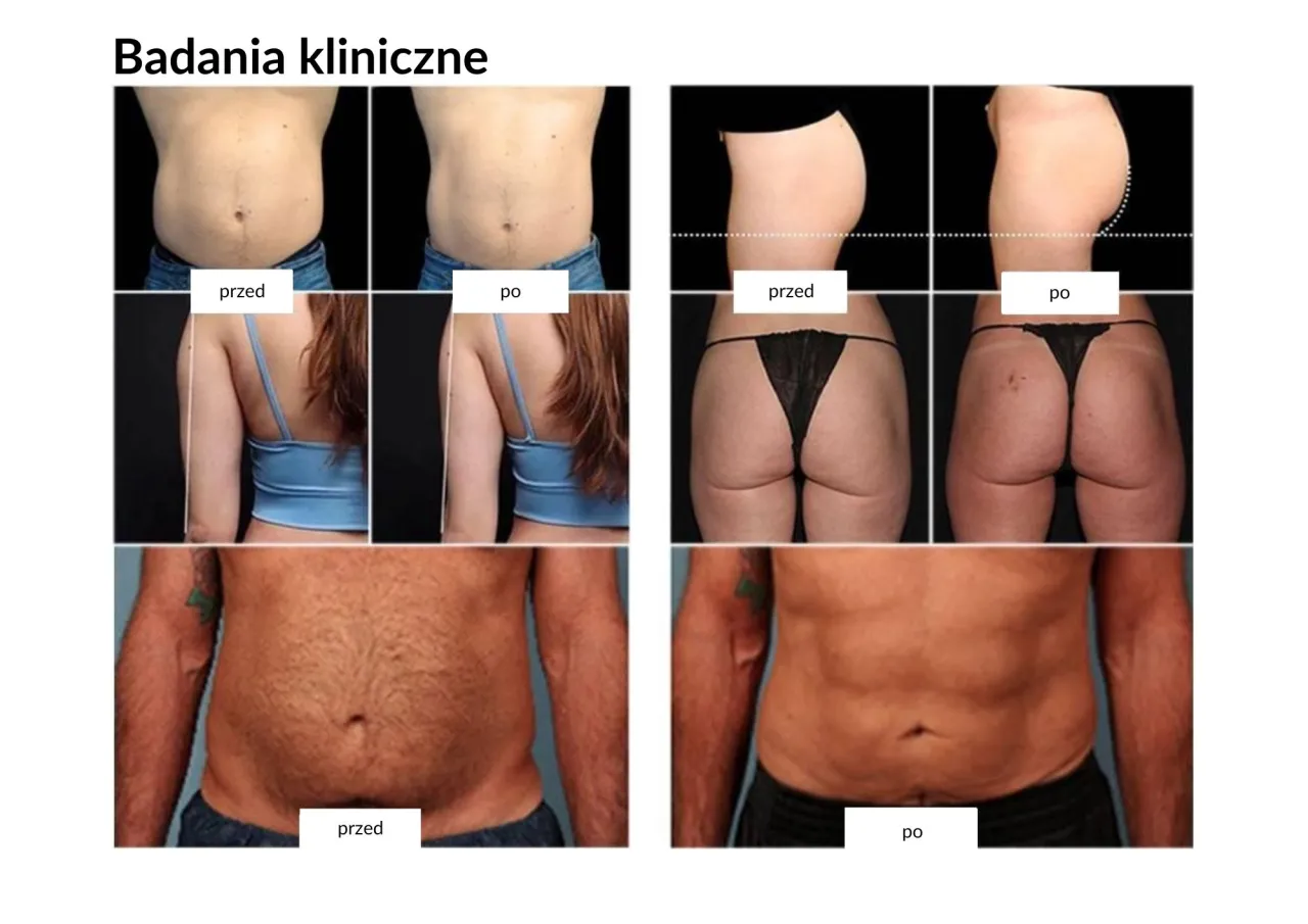 Efekty treningu EMS przed i po