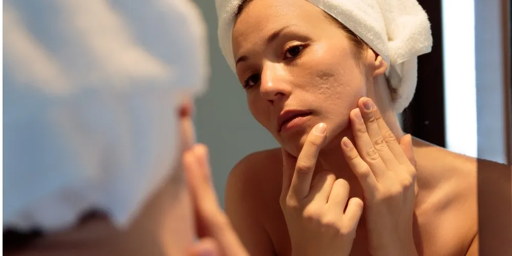 Kobieta wykonująca poranną pielęgnację cery trądzikowej
