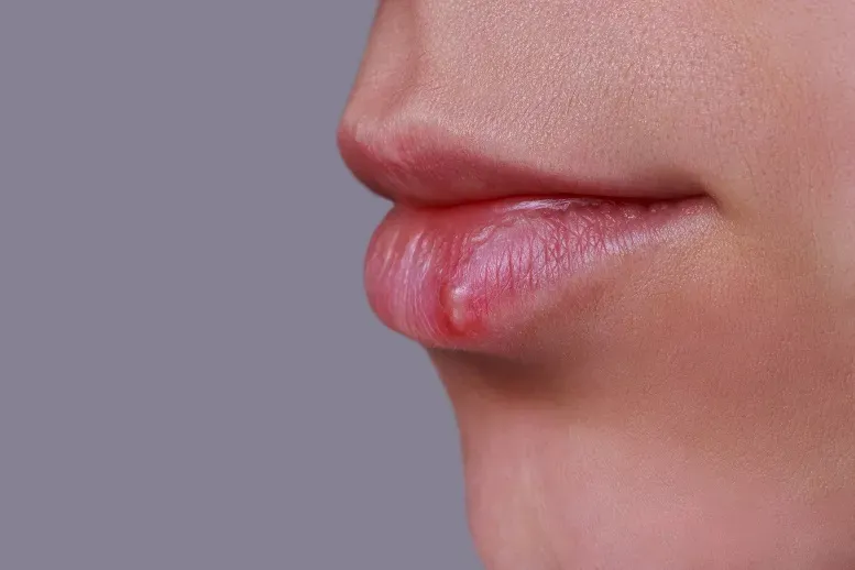 Zdjęcie Czy z zimnem można iść do dentysty? Dowiedz się, co grozi