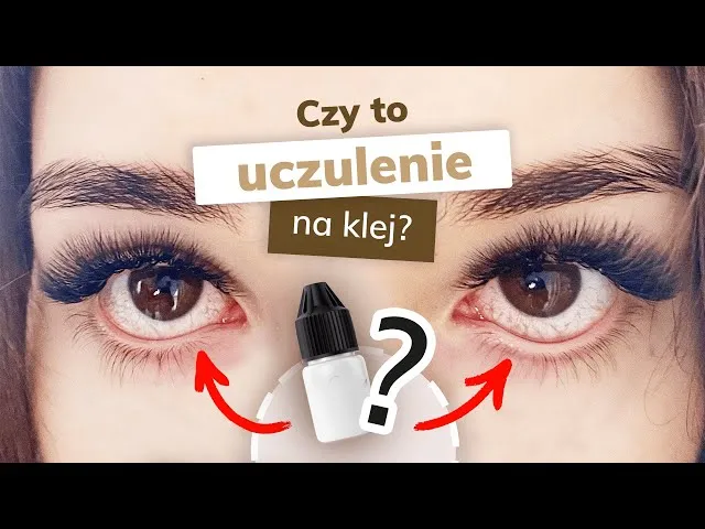 Alergia na klej do rzęs objawy por&oacute;wnanie