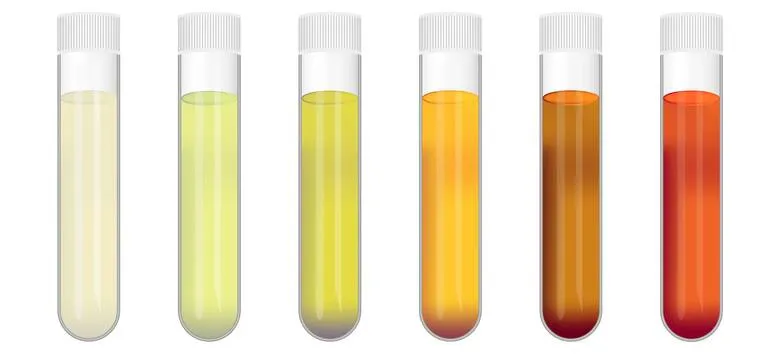 Kolory moczu objawy choroby nerek