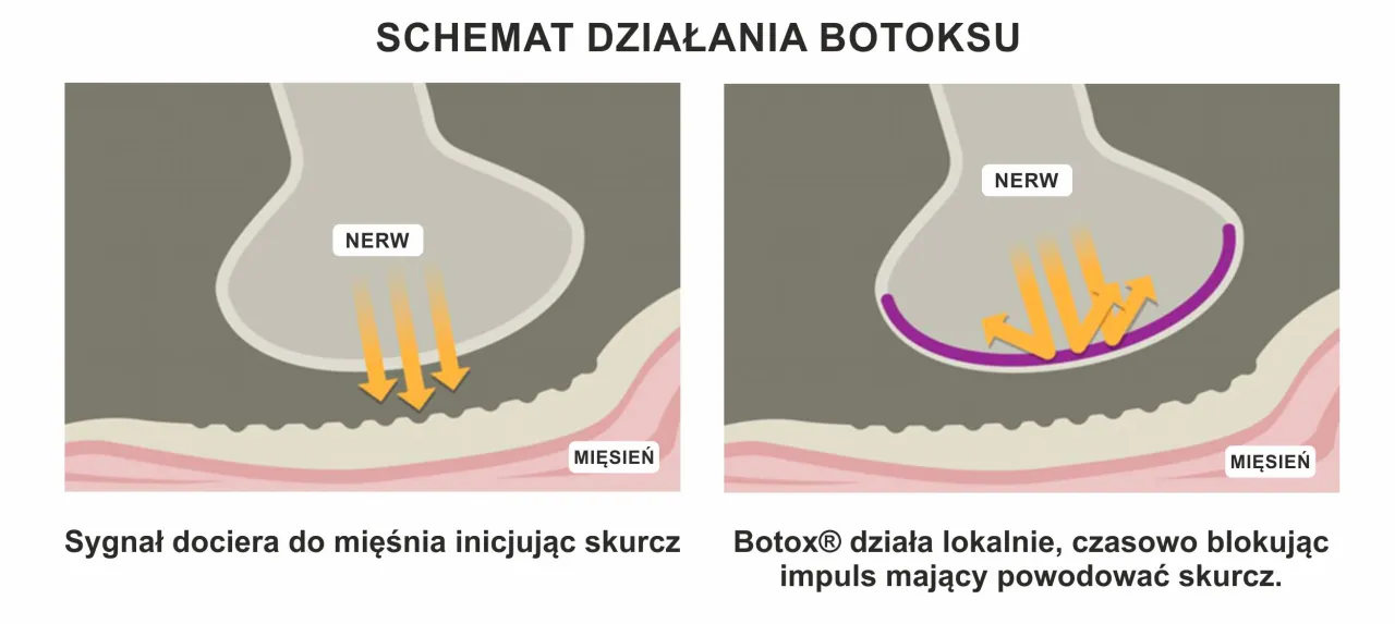 Botoks mechanizm działania