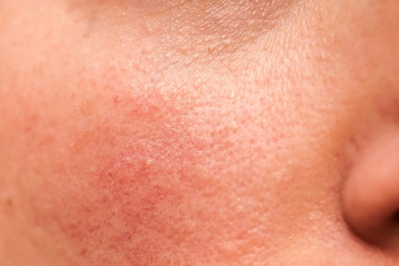 Lekarz dermatolog rozmawiający z pacjentem o alergii skórnej