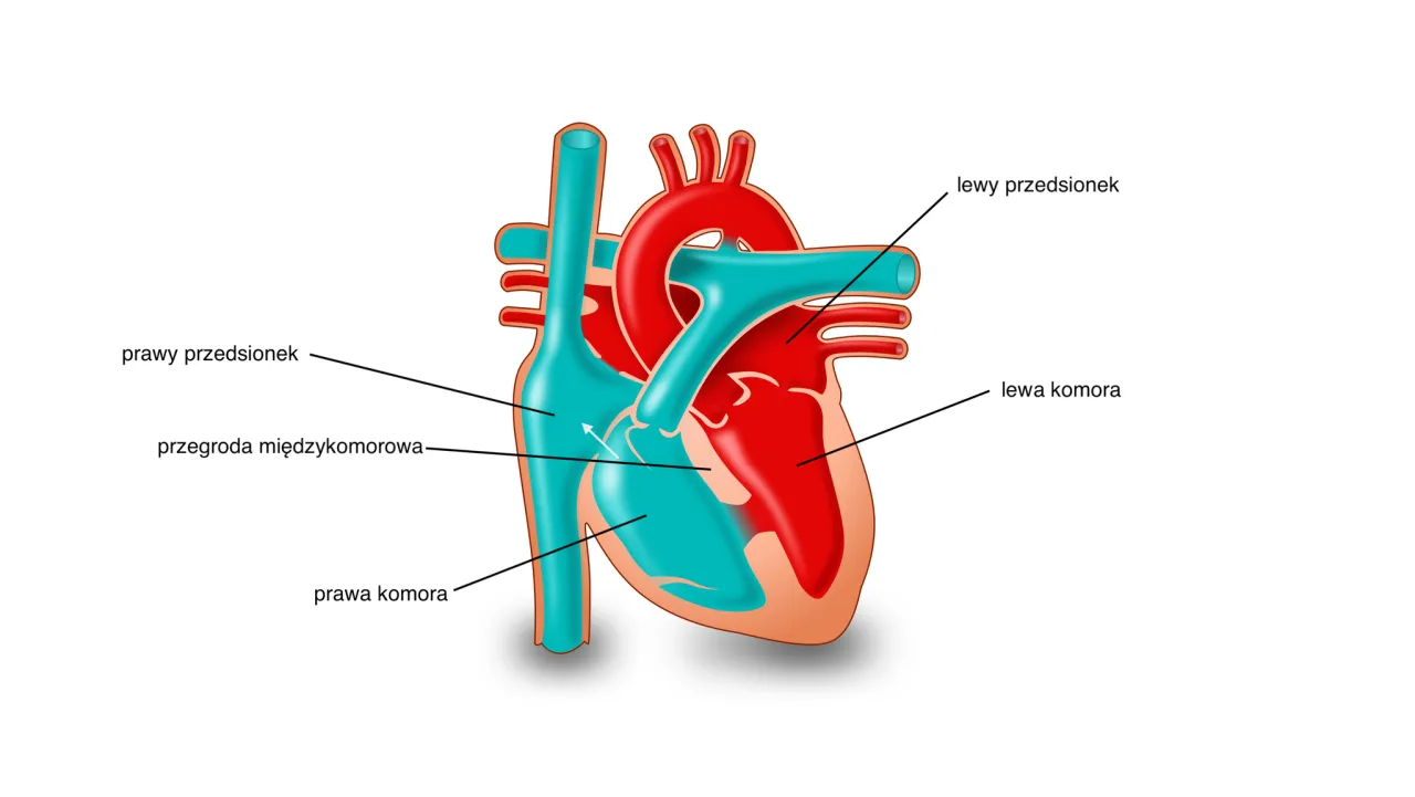 Wady zastawkowe serca schemat