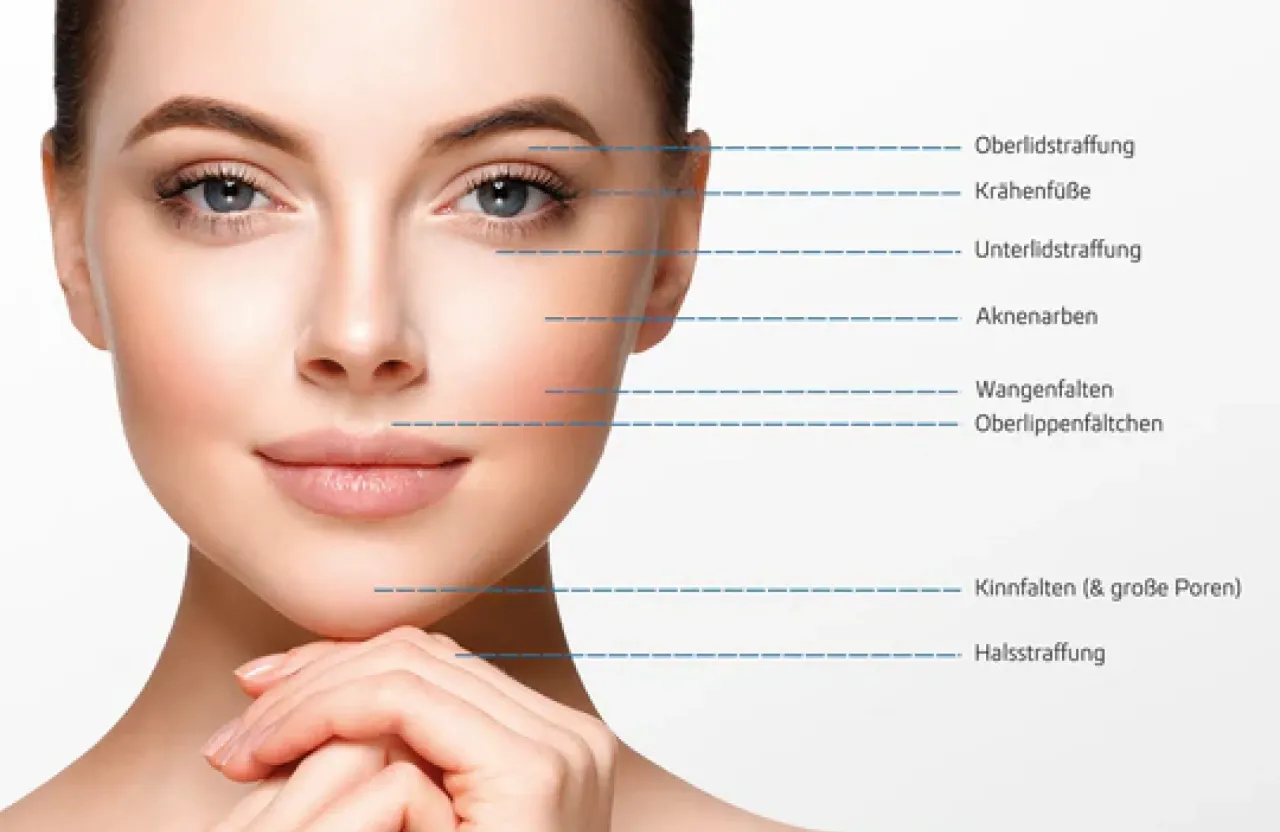 &auml;sthetische behandlungen hautstraffung