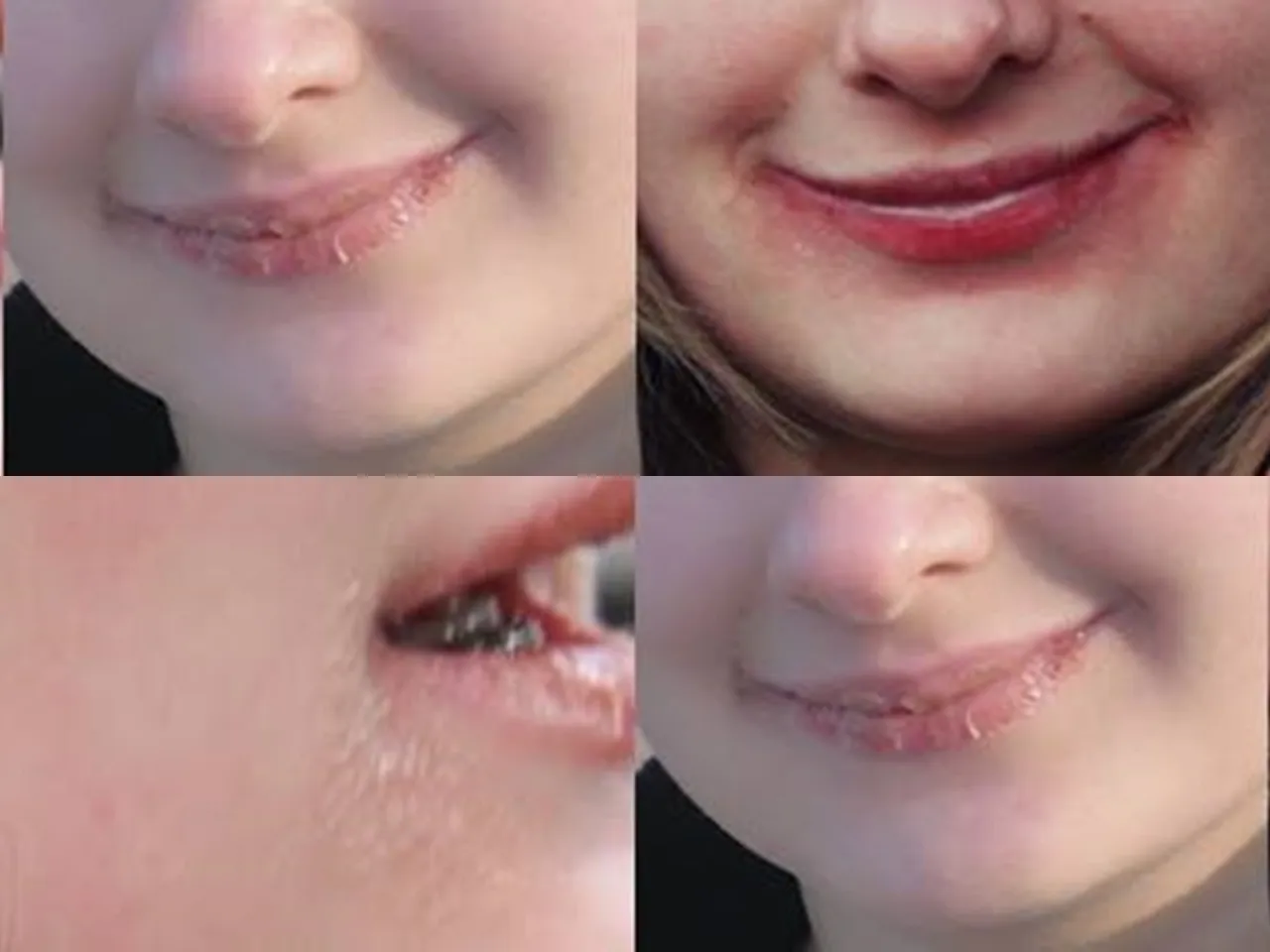 Sucha skóra Izotek pielęgnacja