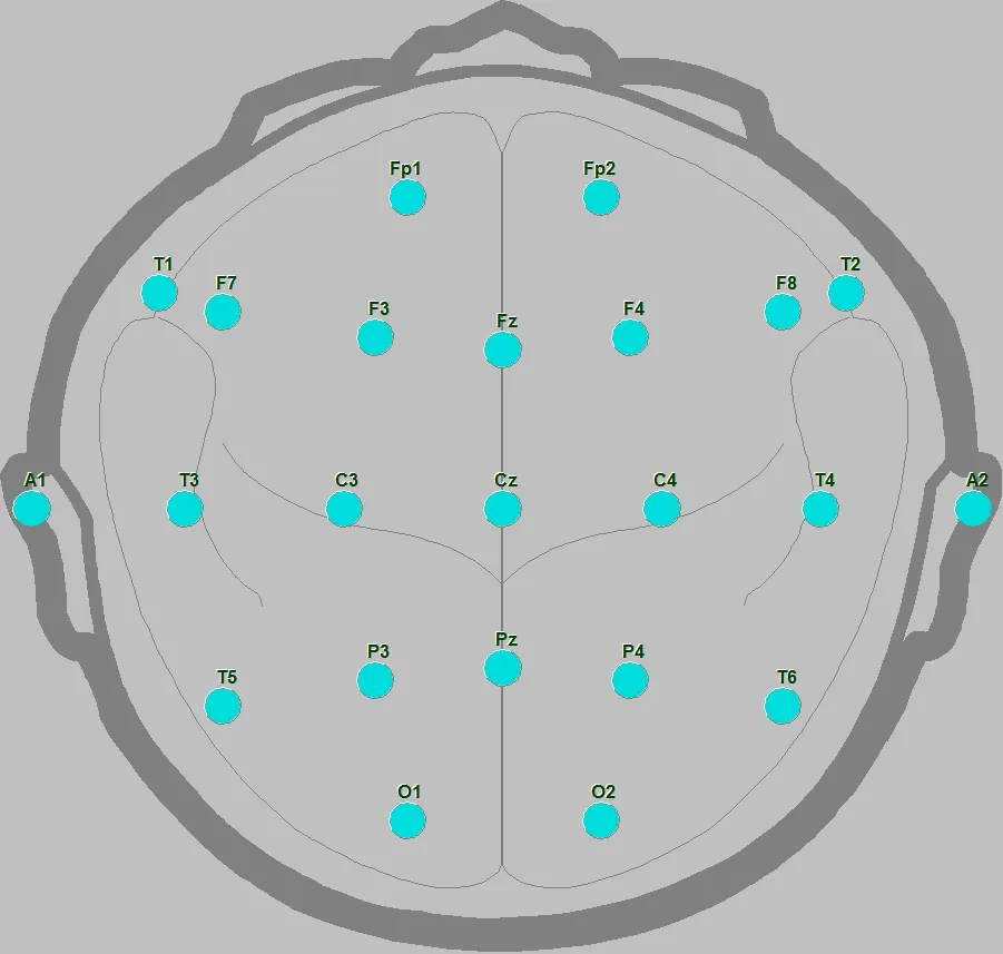 badanie eeg schemat, elektroencefalografia jak wygląda