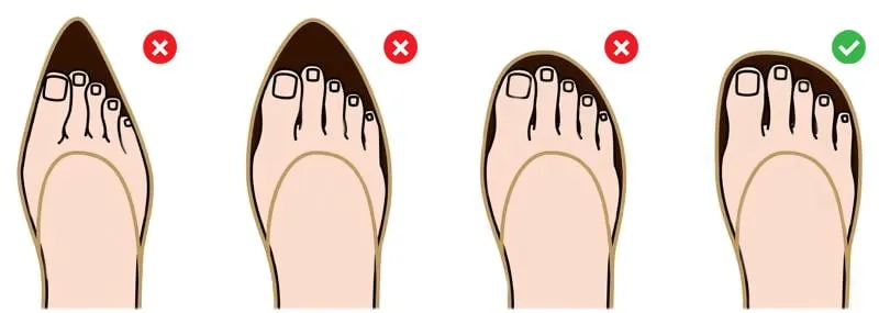 nieodpowiednie obuwie haluksy