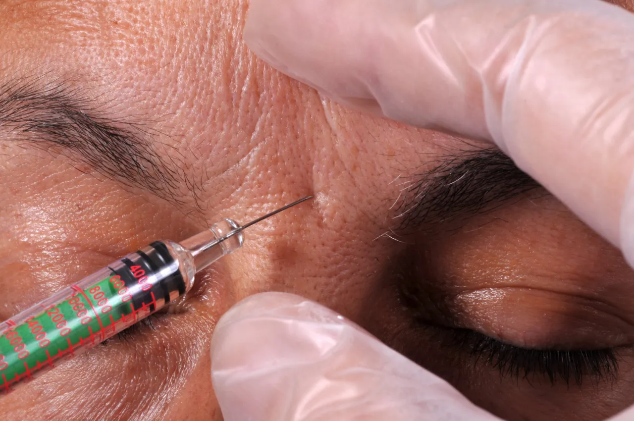 Alternatywy dla botoksu w medycynie estetycznej