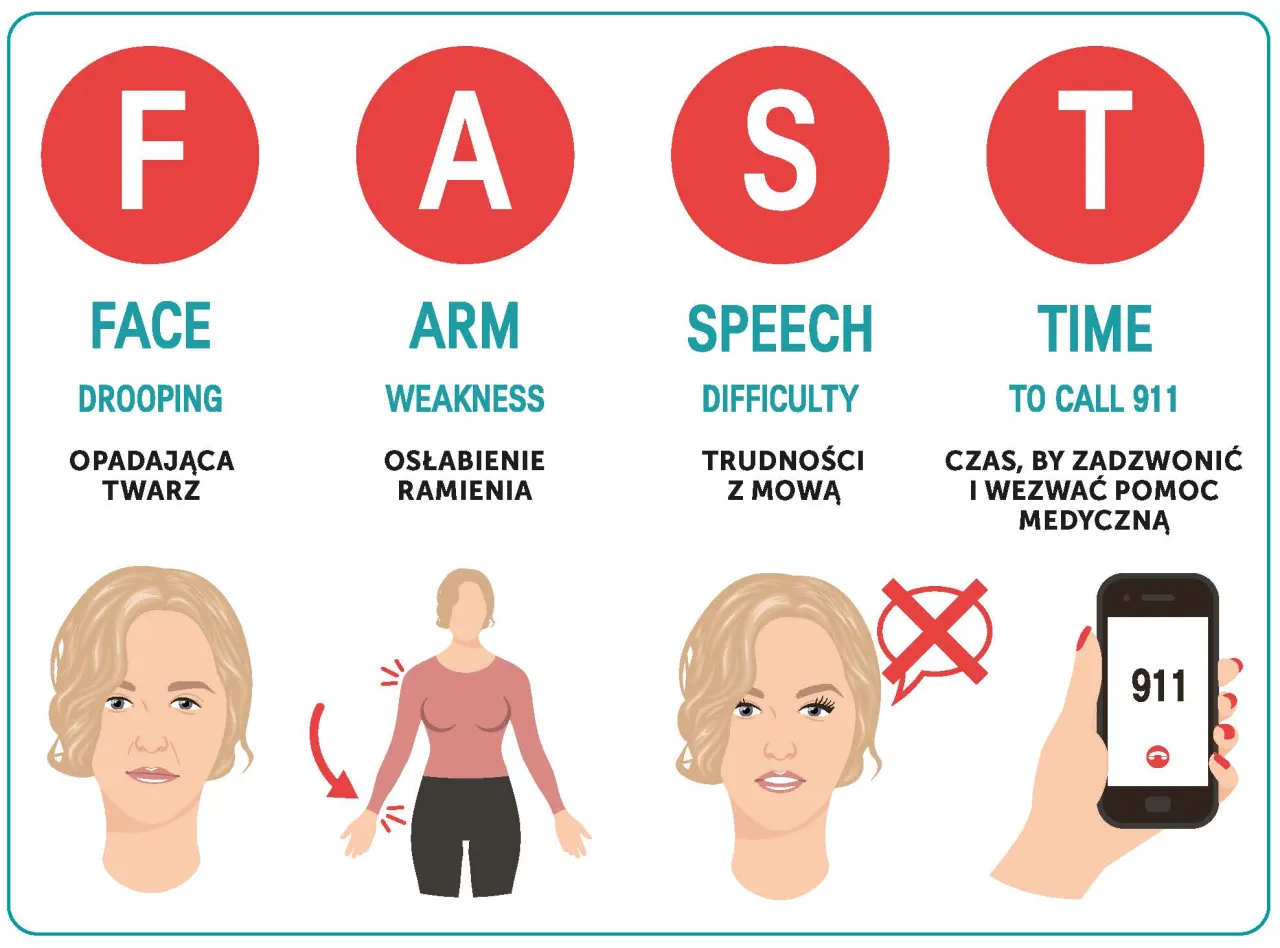 Rodzaje udaru m&oacute;zgu infografika
