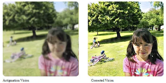 dziecko przekrzywia głowę astygmatyzm