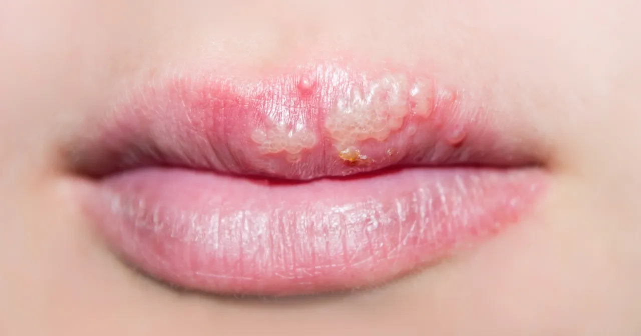 Osoba stosująca pomadkę ochronną z filtrem UV