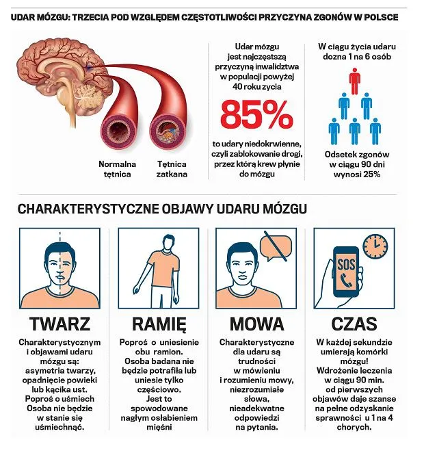 Zdjęcie Mini udar – objawy, leczenie i jak uniknąć poważnych konsekwencji