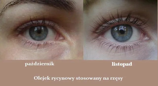 Zdjęcie Jaki olejek rycynowy na rzęsy? Odkryj najlepsze produkty i efekty