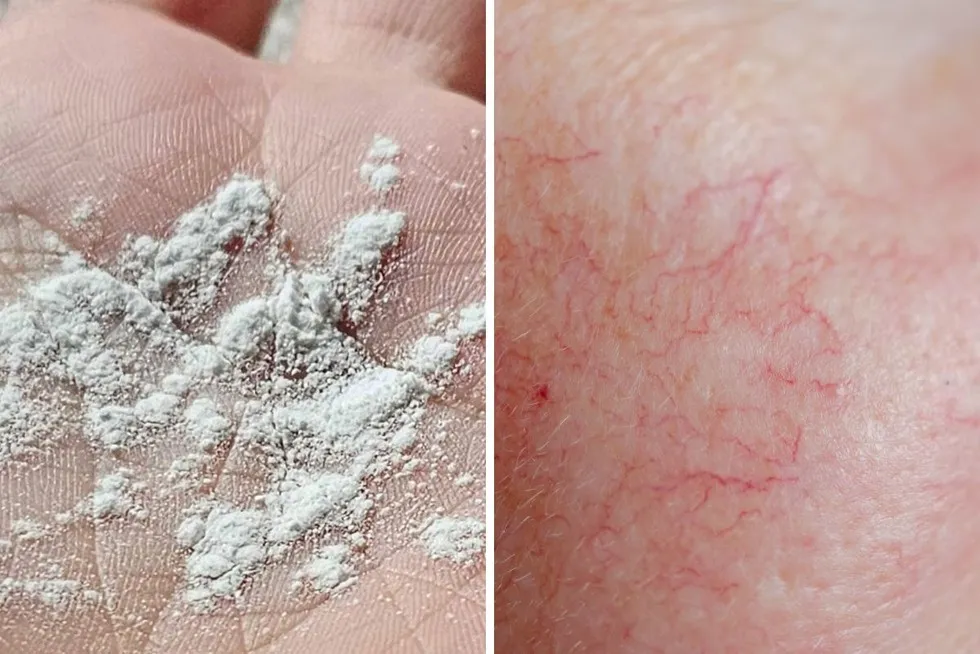 Zdjęcie Peeling enzymatyczny na suchą czy mokrą skórę – która metoda jest lepsza?
