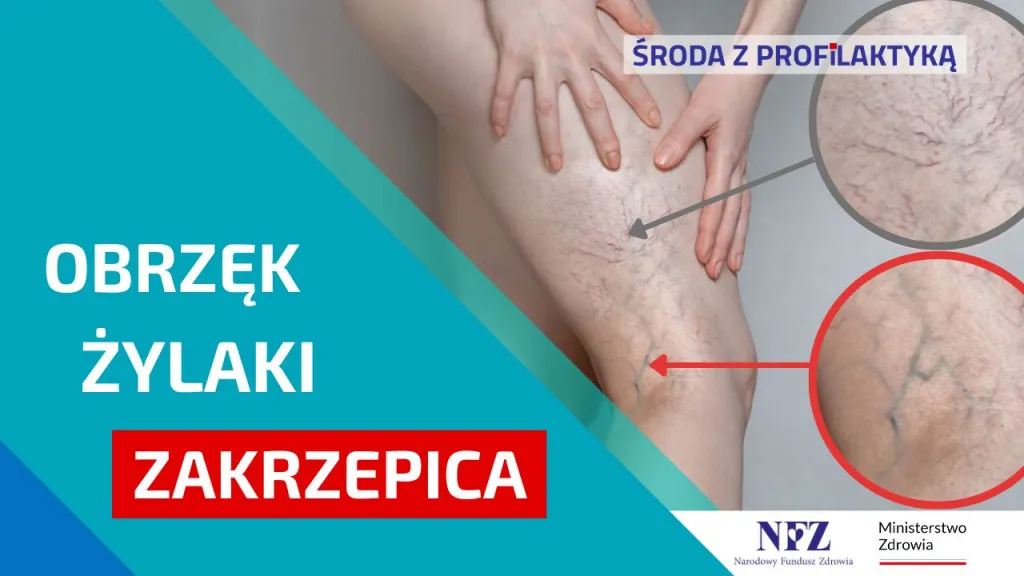 Zdjęcie Do jakiego lekarza zgłosić się z zakrzepicą: kompletna lista specjalistów