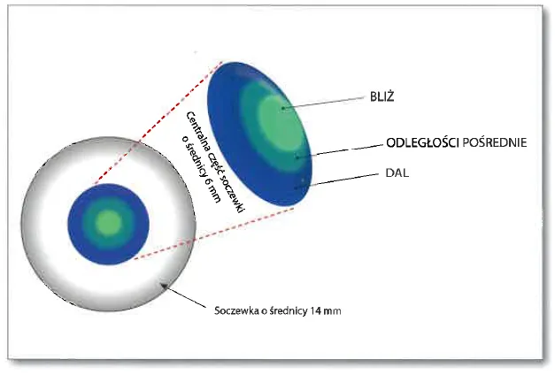 Soczewki multifokalne prezbiopia