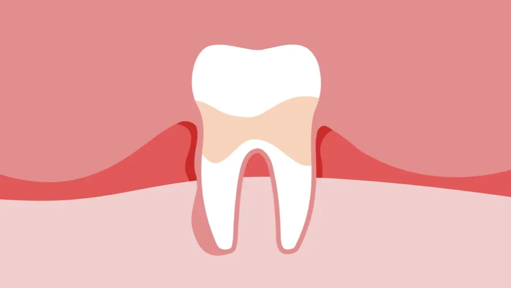 objawy zapalenia dziąseł u dziecka infografika