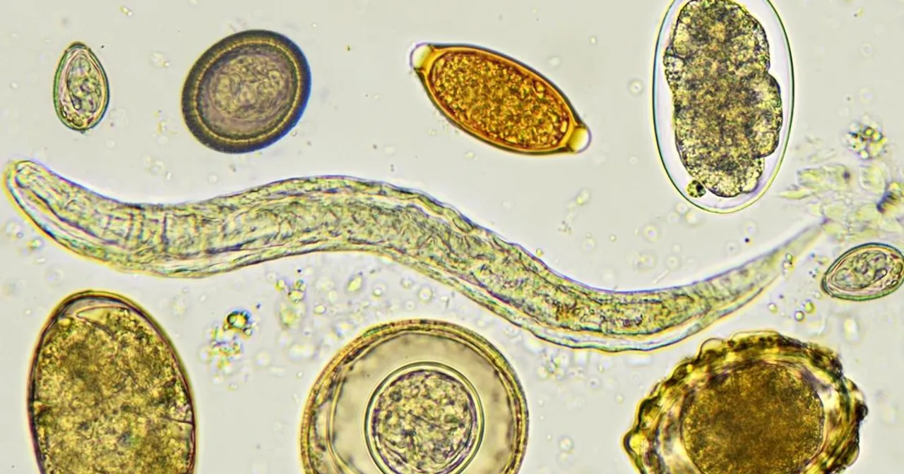 Ból brzucha po lekach