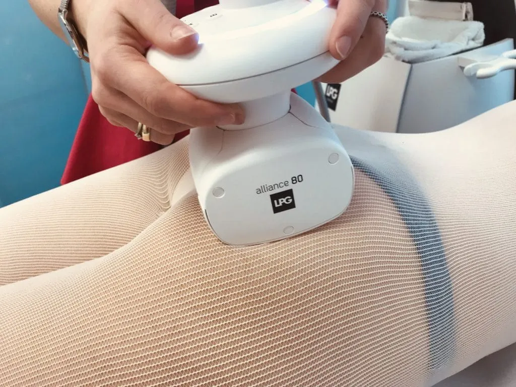 endermologia jak działa urządzenie